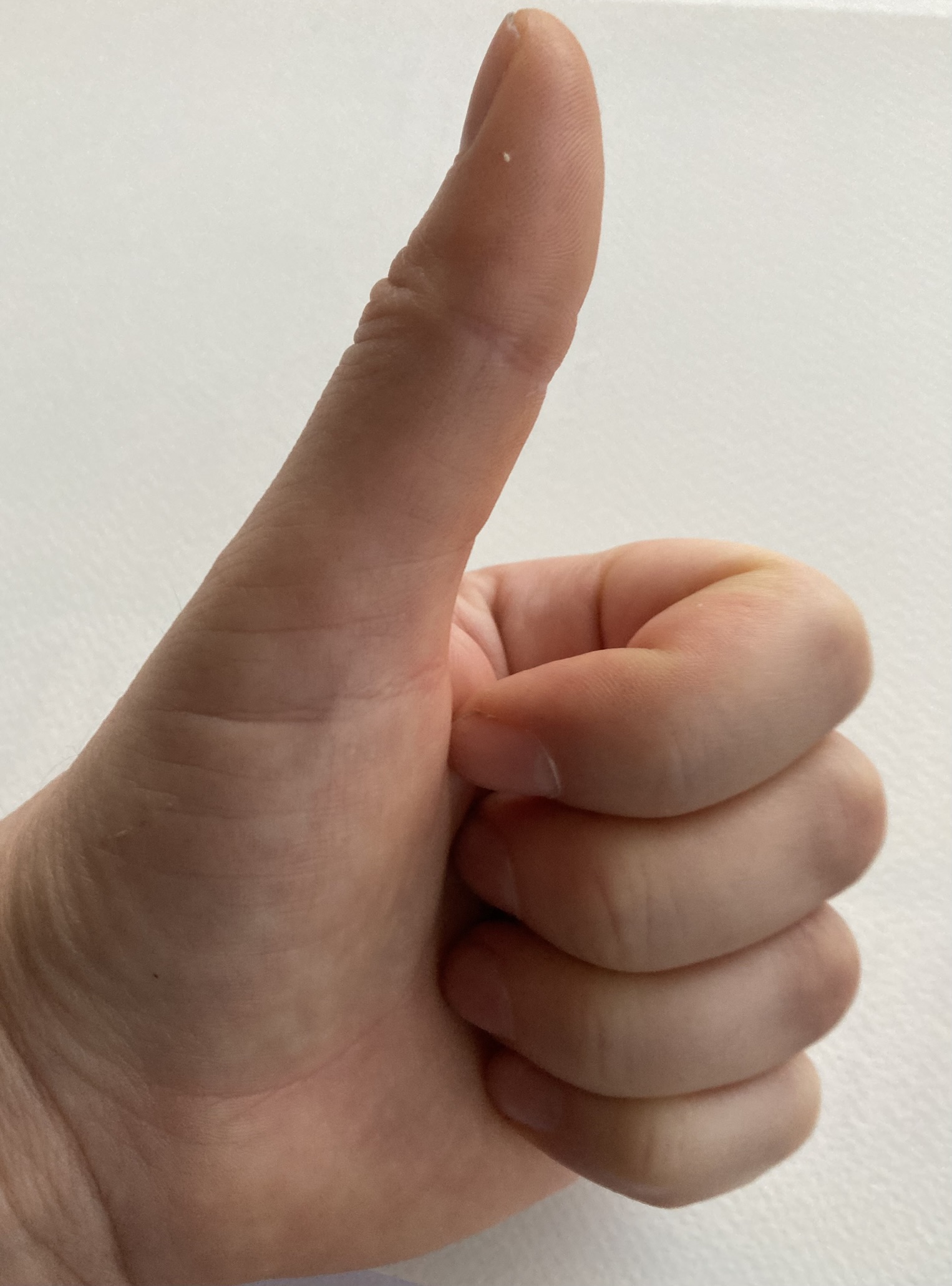 Meine linke Hand ist auf diesem Foto zur Faust geballt, der linke Daumen nach oben gereckt zum "Daumen-hoch"-Zeichen.